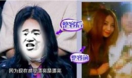 综艺整容爆料视频大全,整容爆料视频大全深度解析