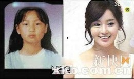 综艺整容爆料视频大全,整容爆料视频大全深度解析