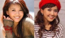 综艺整容爆料视频大全,整容爆料视频大全深度解析